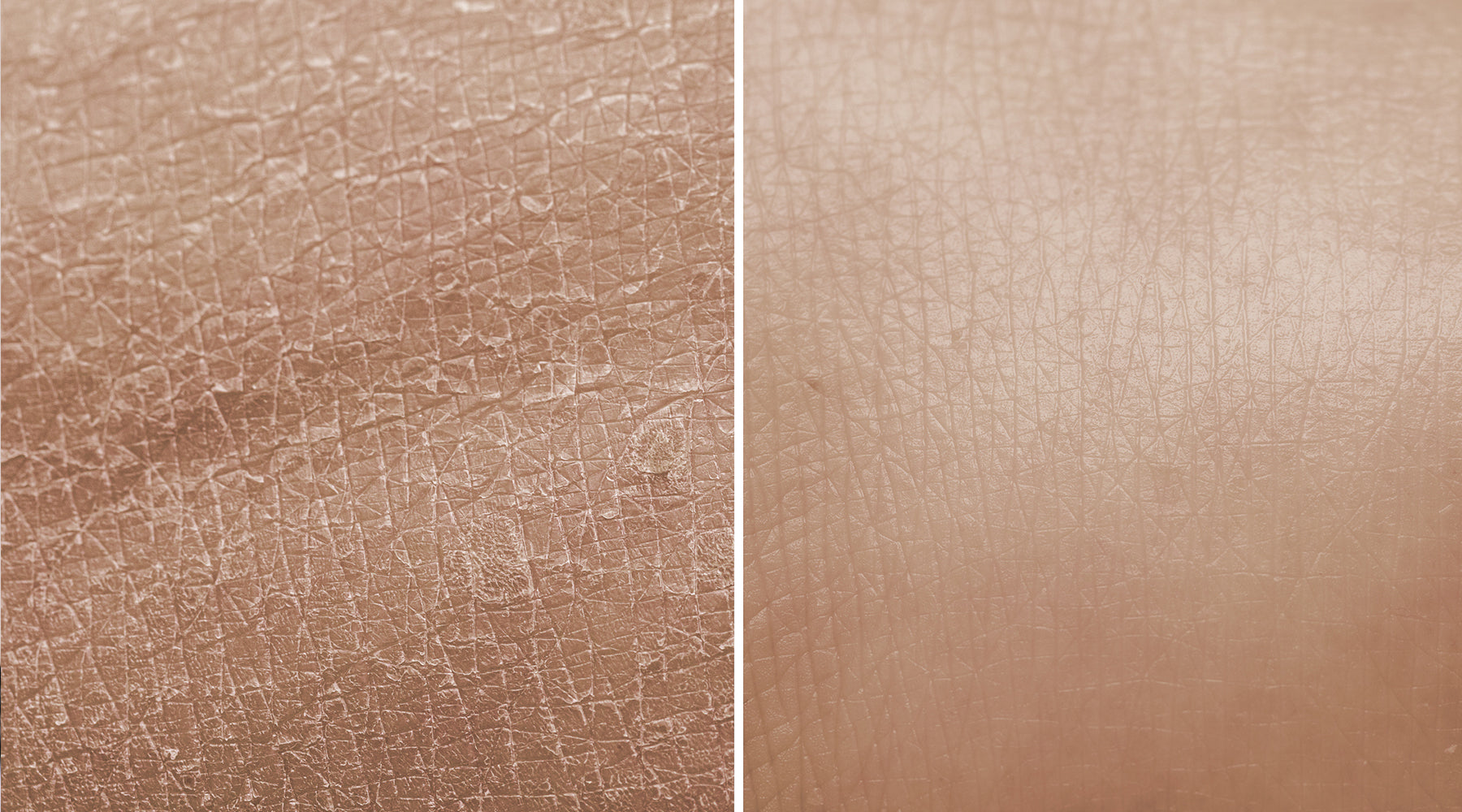Dry Skin Vs Dehydrated Skin